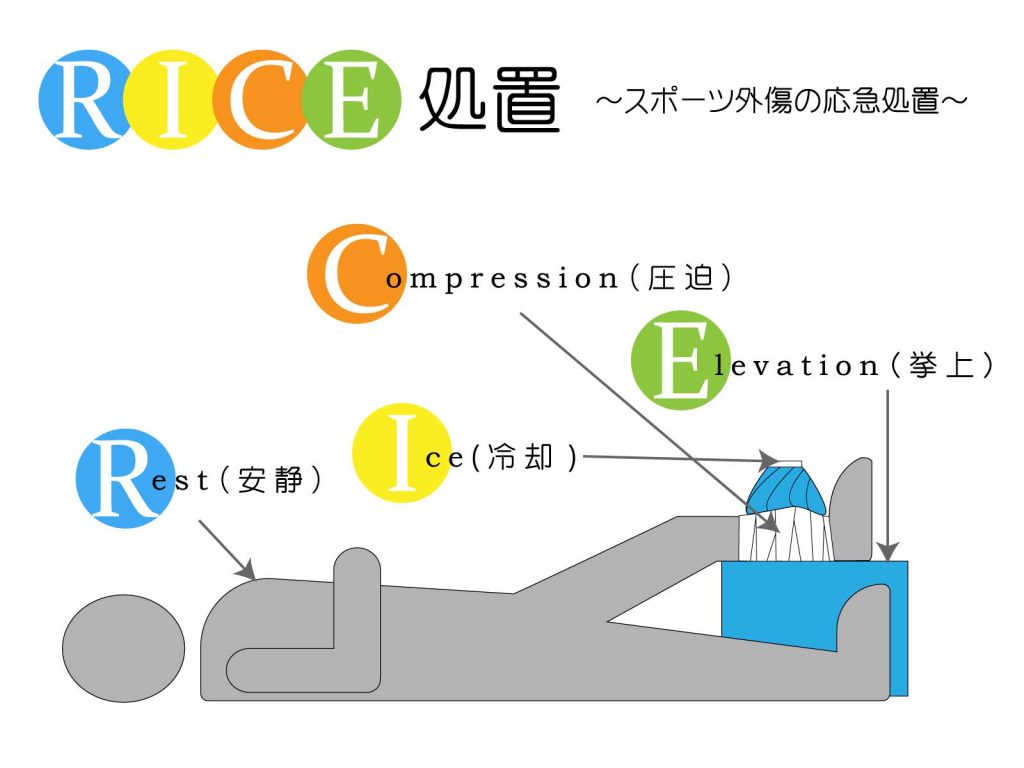 RICE処置